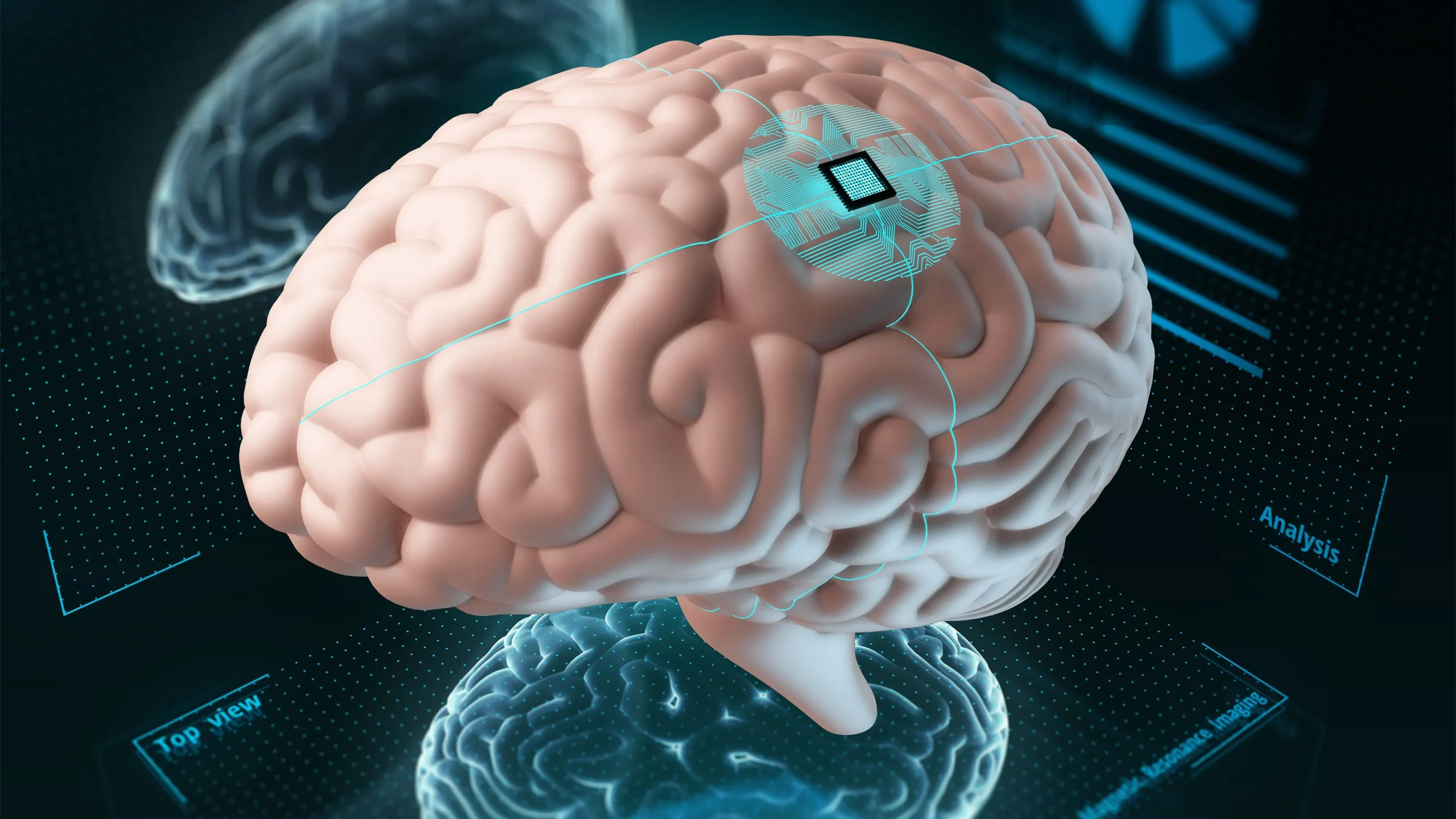 Мгу мозг. Мозговые импланты. Мозг с чипом памяти.